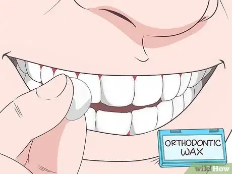 Image titled File Down a Sharp Tooth Step 9