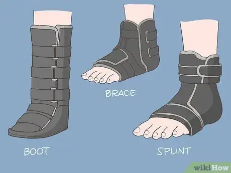 Image titled Treat Syndesmosis Step 8