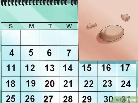 Image titled Get Rid of Skin Tags Step 13