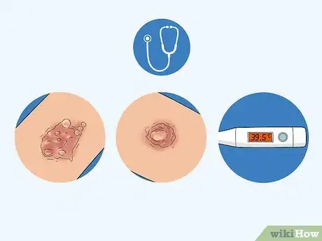 Image titled Treat Eczema with Diet Step 17