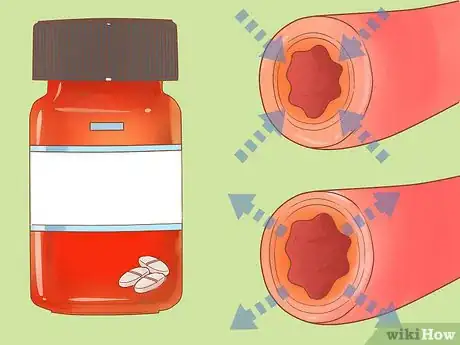 Image titled Prevent a Heart Attack Step 19