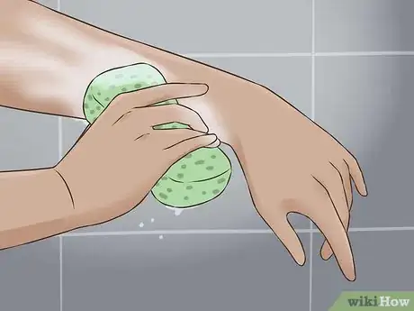 Image titled Eliminate Skunk Odor Step 3