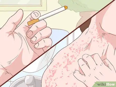 Image titled Stop a Burning Throat Step 19