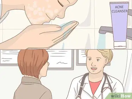 Image titled Maintain the Beauty of Your Face Step 10