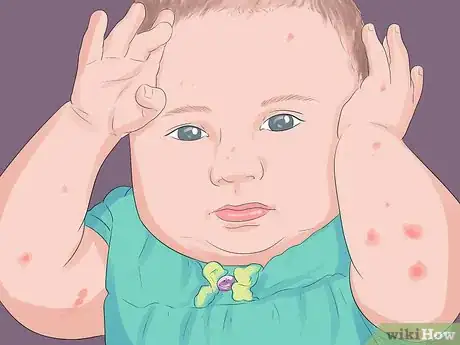 Image titled Know When to Call the Doctor If Your Baby or Child Is Sick Step 7