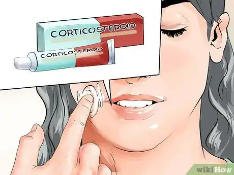 Image titled Reduce Eczema Itching Step 14