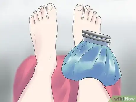 Image titled Treat a Broken Ankle Step 6