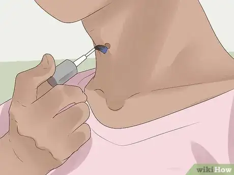 Image titled Get Rid of Skin Tags Step 18