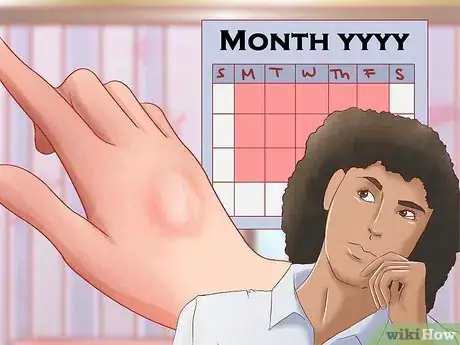 Image titled Recognize Frostbite Step 12