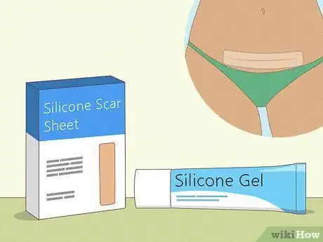 Image titled Lighten a C‐Section Scar Step 4