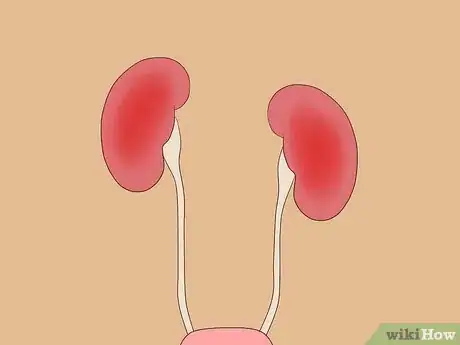 Image titled Treat Hypocalcemia Step 7