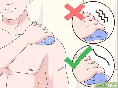 Image titled Achieve Psoriasis Remission Step 8