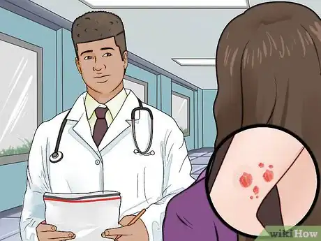 Image titled Reduce Lymphoma Risk with Psoriasis Step 5