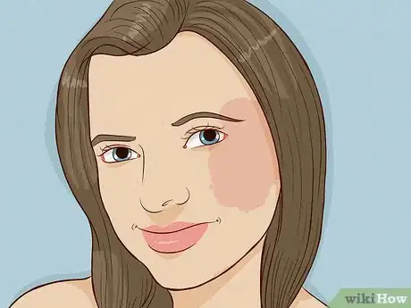 Image titled Deal With Birthmarks Step 5