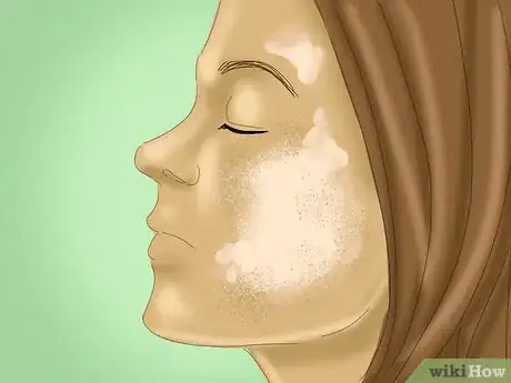 Image titled Prevent Hyperpigmentation of the Skin Step 4