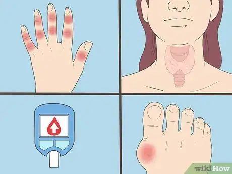 Image titled Diagnose Bursitis Step 6