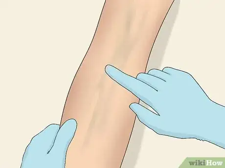 Image titled Inject Into a Vein Step 9