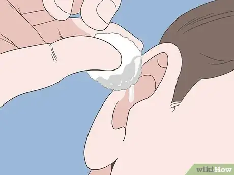 Image titled Prevent Cerumen Impaction Step 2