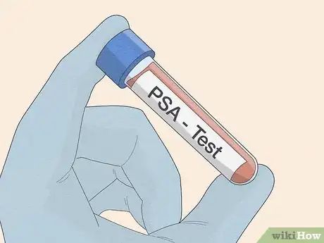 Image titled Treat Prostate Cancer with Androgen Deprivation Therapy Step 2