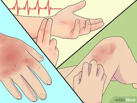 Image titled Diagnose Erythrodermic Psoriasis Step 4