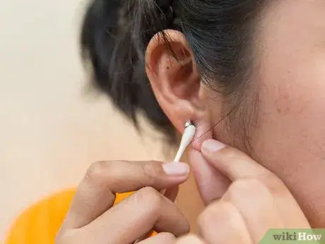 Image titled Clean Your Ear Piercing Step 3