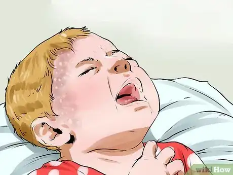 Image titled Know if You Have Eczema Step 2