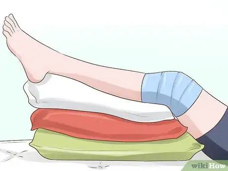 Image titled Treat a Growth Plate Fracture Step 13