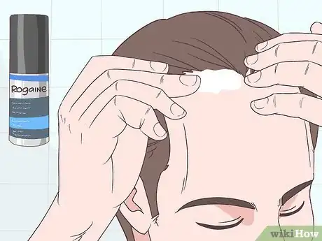 Image titled Make Your Hairline Grow Back Step 1