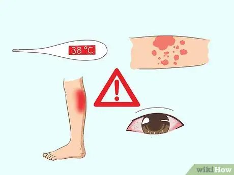 Image titled Get Tested for Zika Step 2