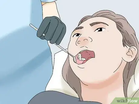 Image titled Clean Wisdom Teeth Step 11