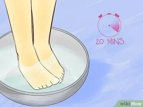 Image titled Use Foot Baths for Athlete’s Foot Step 17