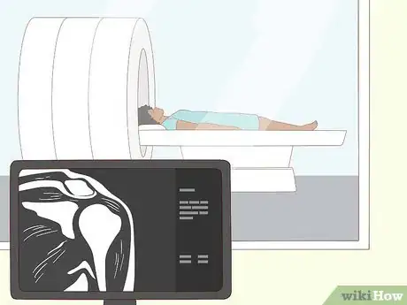 Image titled Identify a Rotator Cuff Injury Step 9