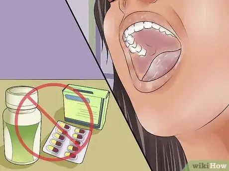 Image titled Prevent Plaque Step 10