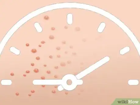 Image titled Identify Fire Ant Stings Step 10