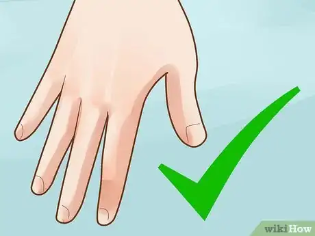 Image titled Prevent Frostbite Step 29