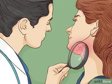 Image titled Treat Sunburn with Natural Remedies Step 13