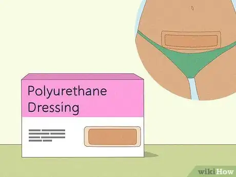 Image titled Lighten a C‐Section Scar Step 5