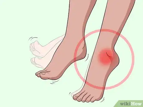 Image titled Treat MS‐Related Foot Drop Step 13