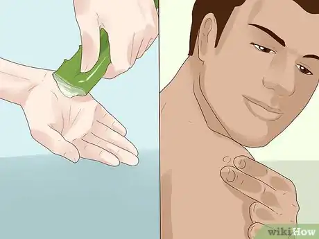 Image titled Get Rid of Skin Tags Step 10