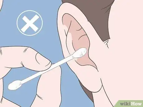 Image titled Prevent Cerumen Impaction Step 6