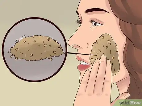 Image titled Treat Cystic Acne Step 15