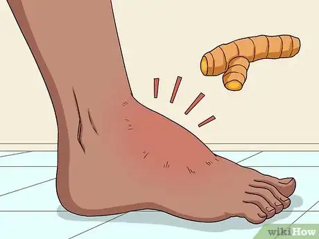 Image titled Relieve Chronic Pain Naturally Step 3