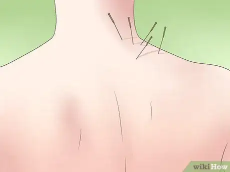 Image titled Treat a Cold with Traditional Chinese Medicine Step 12