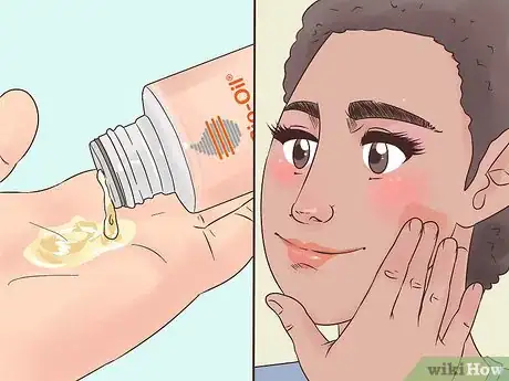 Image titled Use Bio Oil Step 14