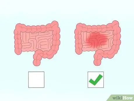 Image titled Diagnose Celiac Disease Step 4