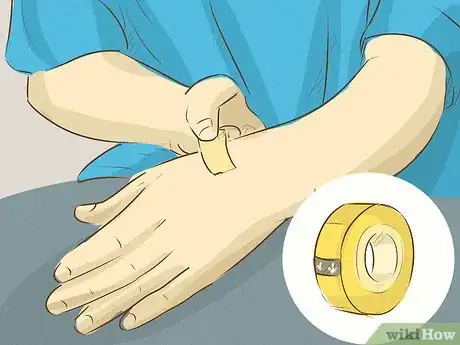 Image titled Stop Scratching a Mosquito Bite Step 6