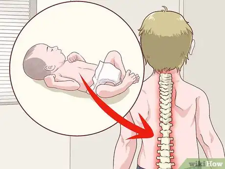 Image titled Diagnose Low Bone Density in Kids Step 7