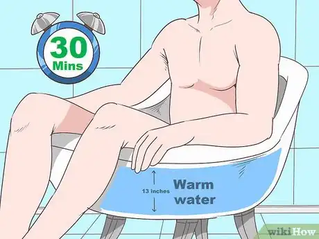 Image titled Know if You Have Epididymitis Step 20