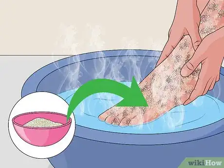 Image titled Make a Peppermint Foot Soak Step 10
