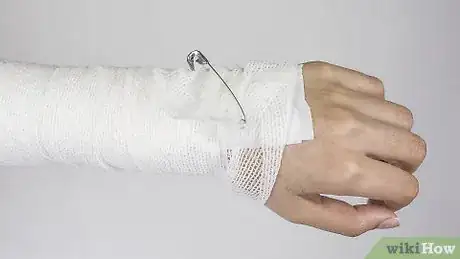 Image titled Strap an Elbow Step 10